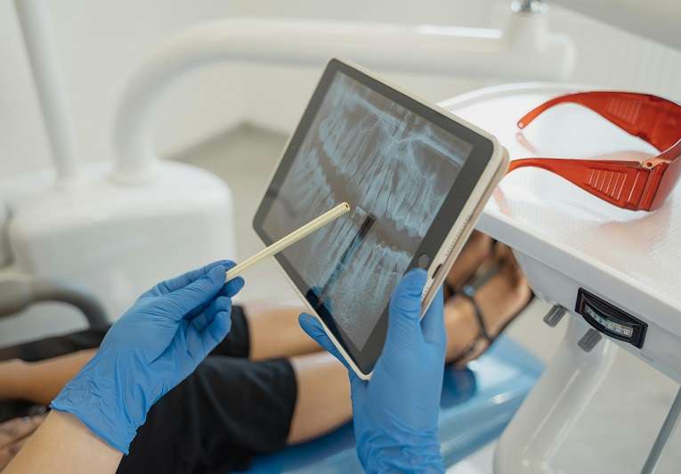 Root Canal Doctor